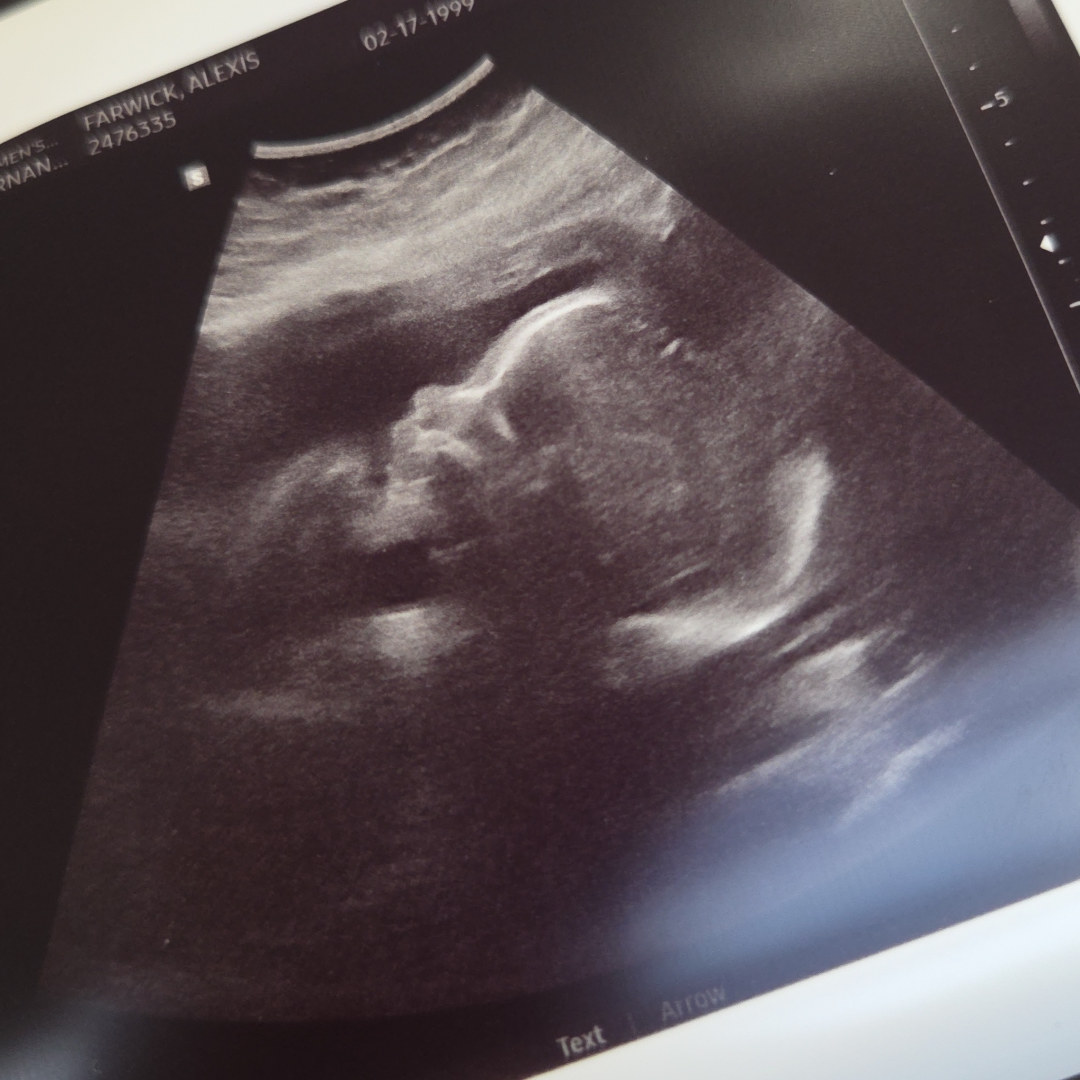 Photo shared by Alexis for their Babylist baby registry.