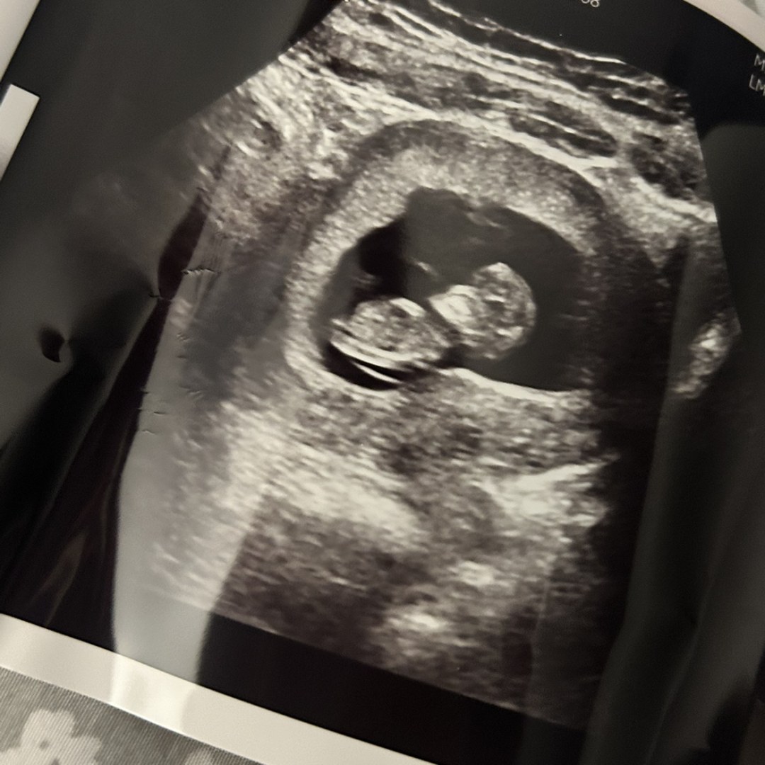 Photo shared by Alexandria for their Babylist baby registry.