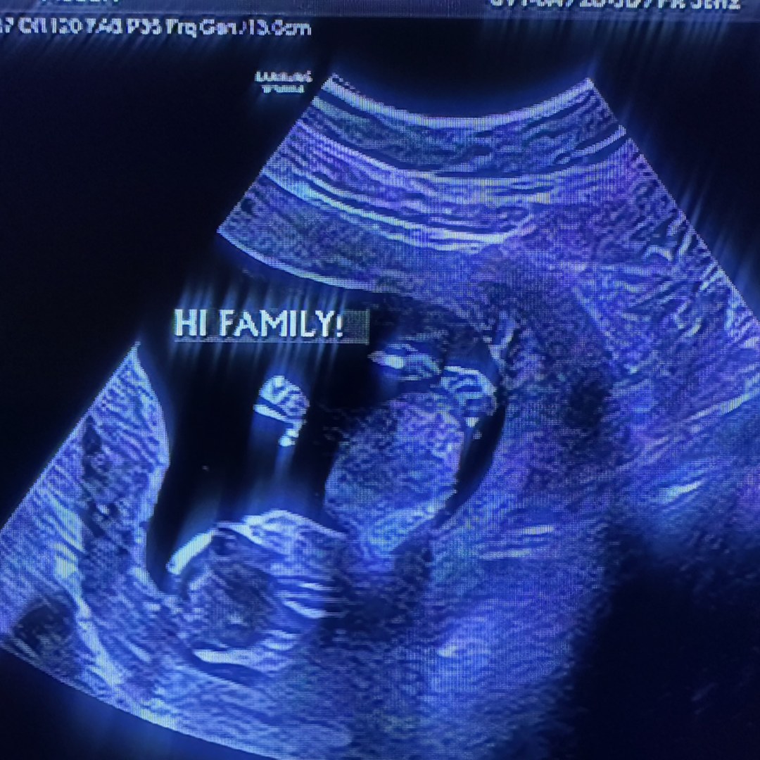 Photo shared by Alexandra for their Babylist baby registry.