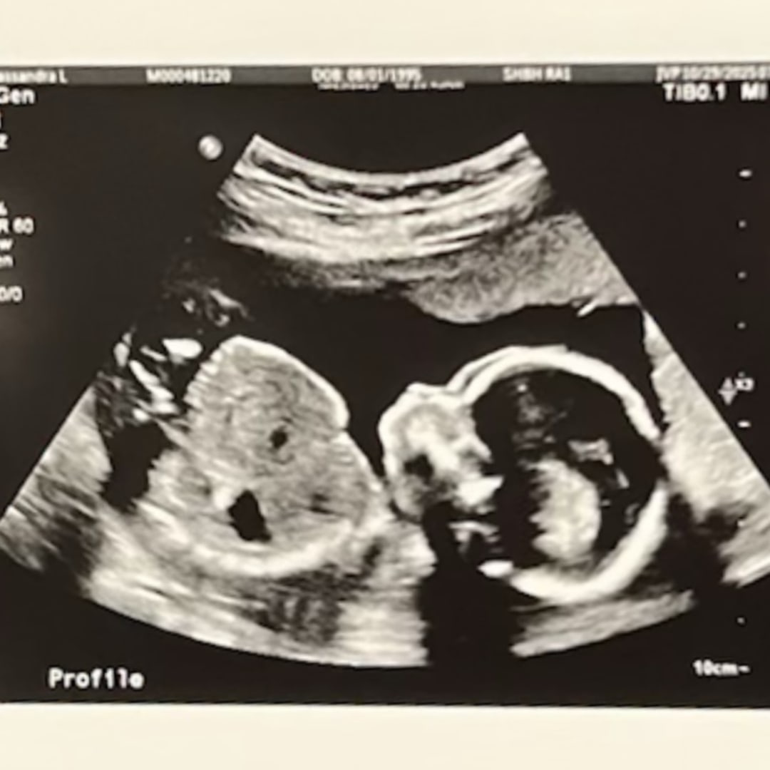 Photo shared by Cassandra for their Babylist baby registry.