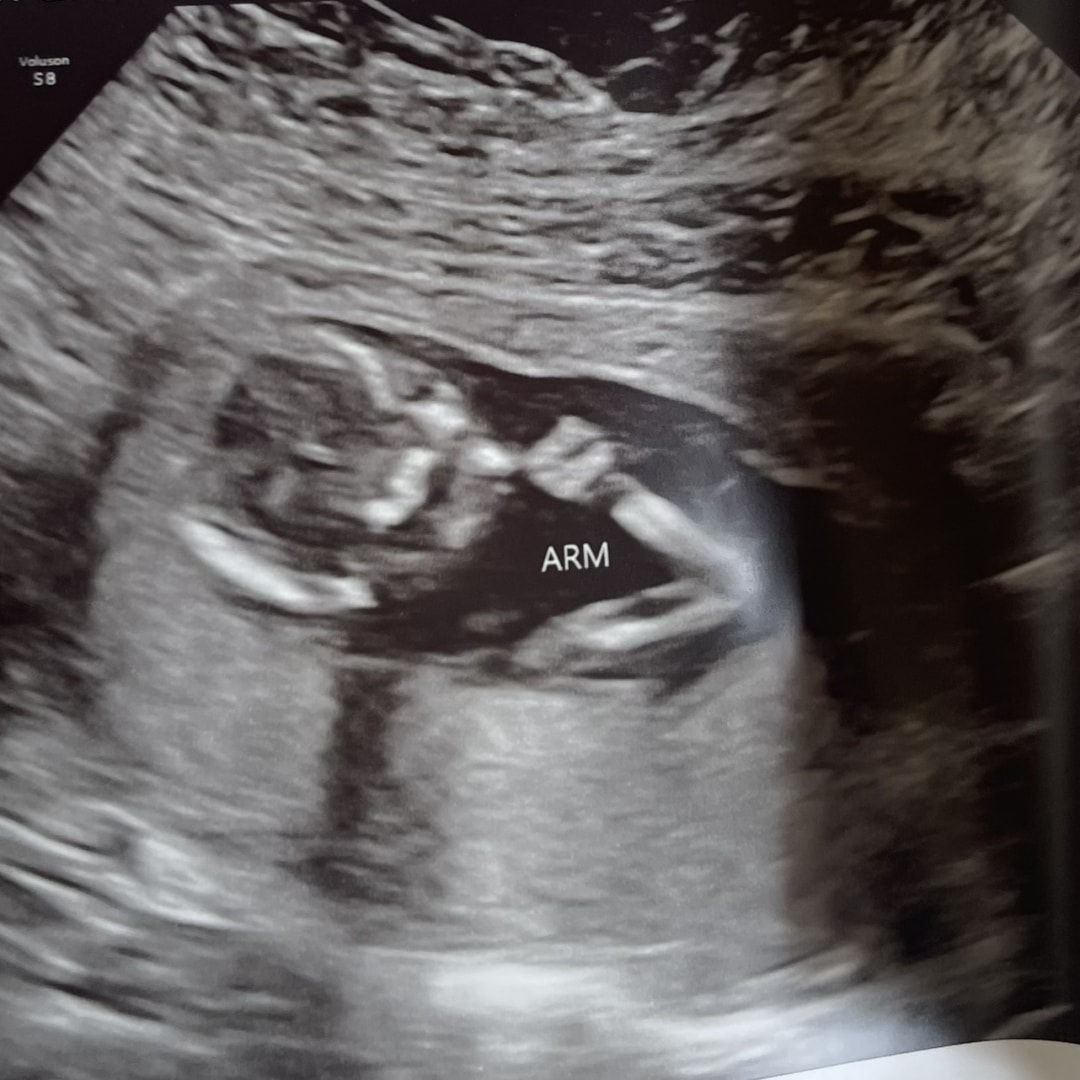 Photo shared by Ariel for their Babylist baby registry.