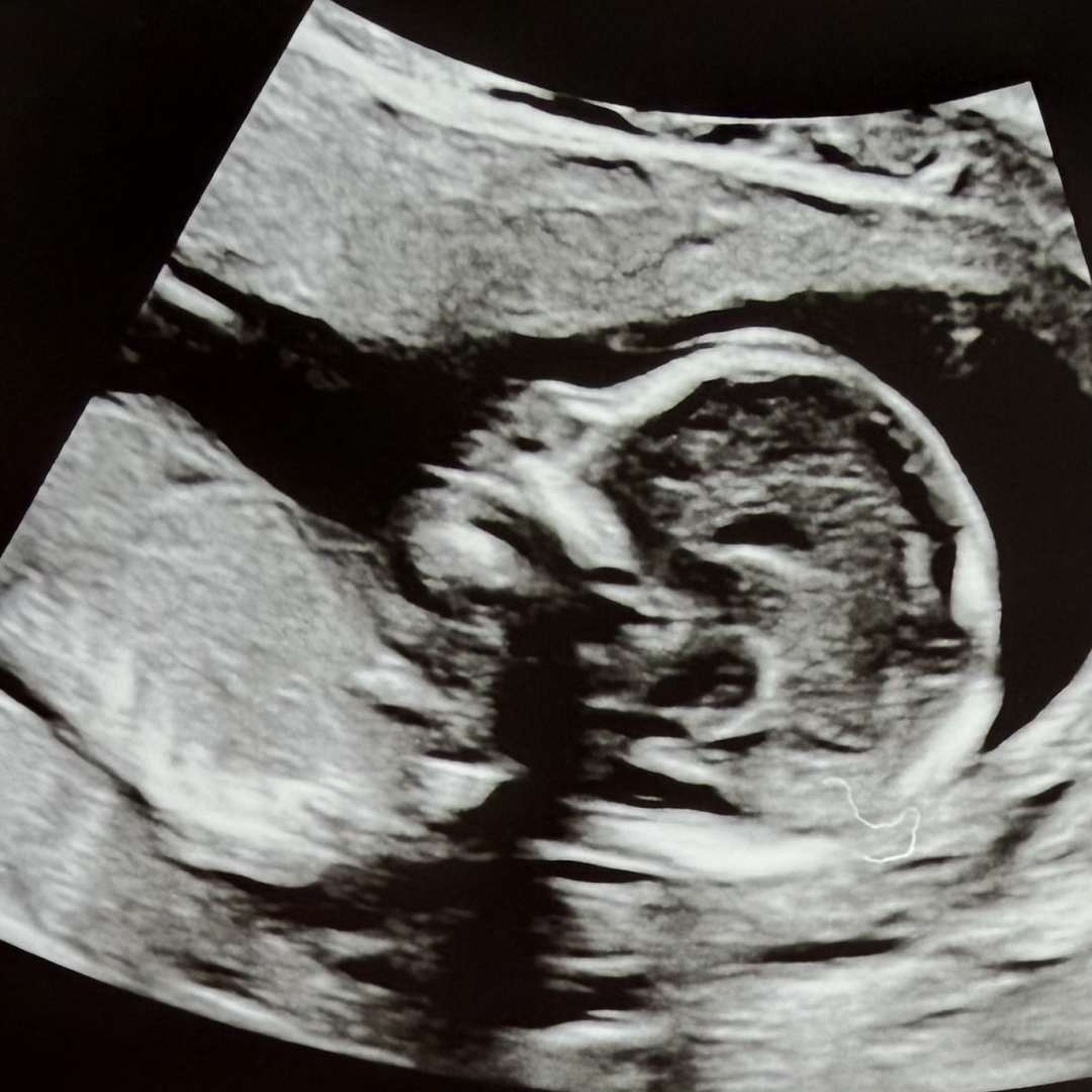 Photo shared by Hannah for their Babylist baby registry.