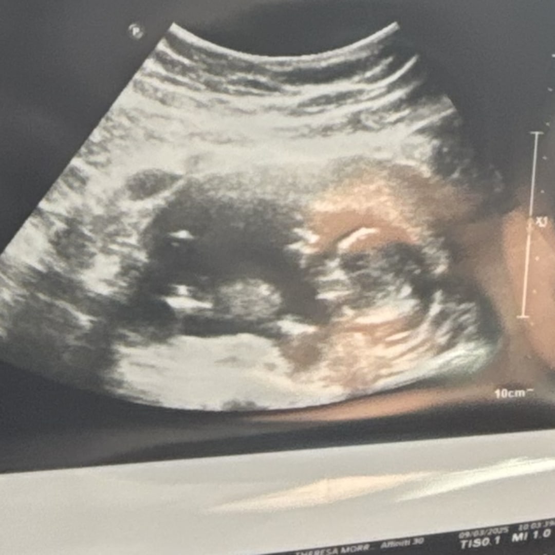 Photo shared by Destany for their Babylist baby registry.