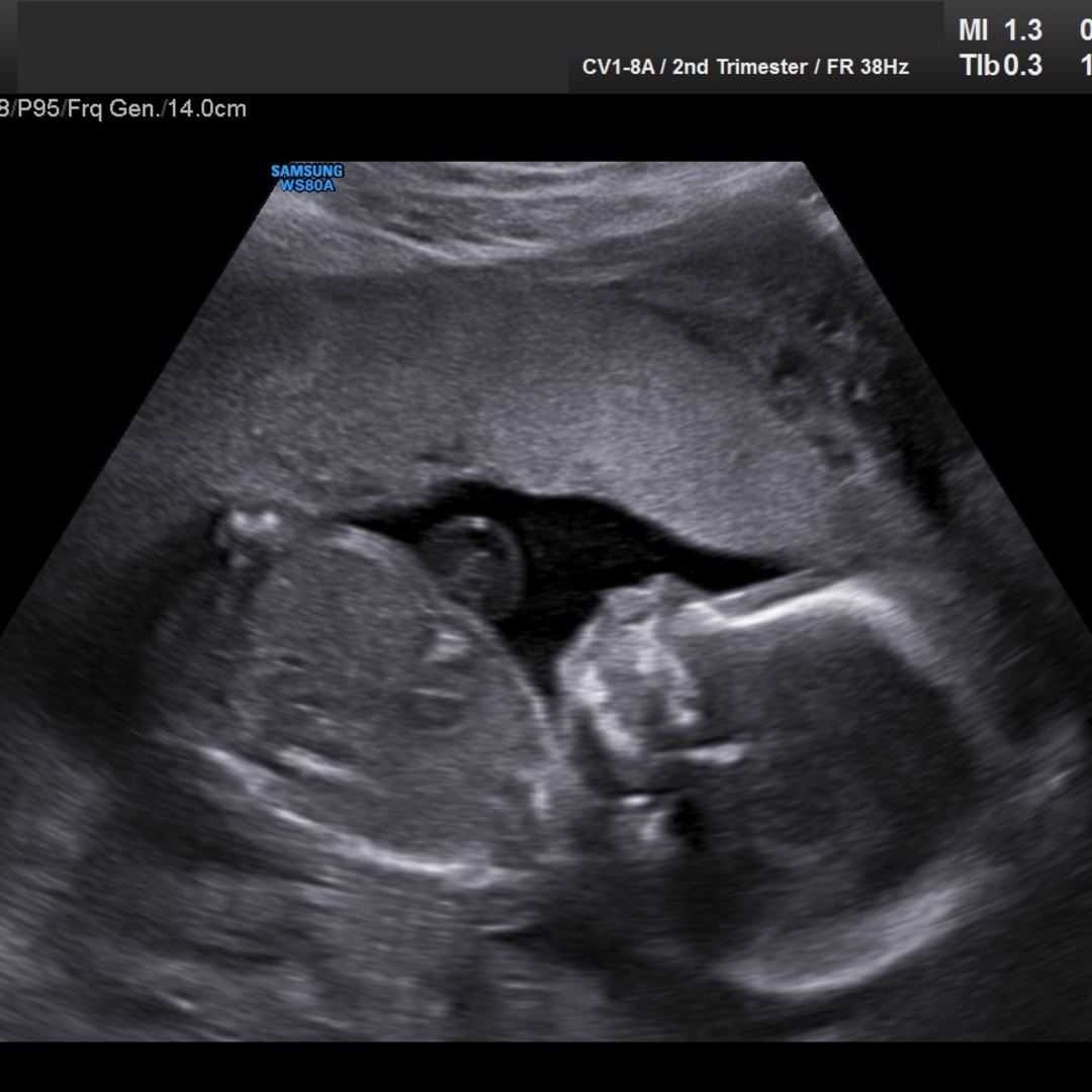 Photo shared by Nayely for their Babylist baby registry.