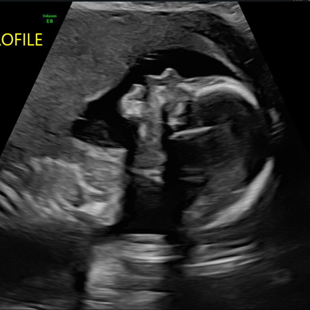 Photo shared by Madi for their Babylist baby registry.