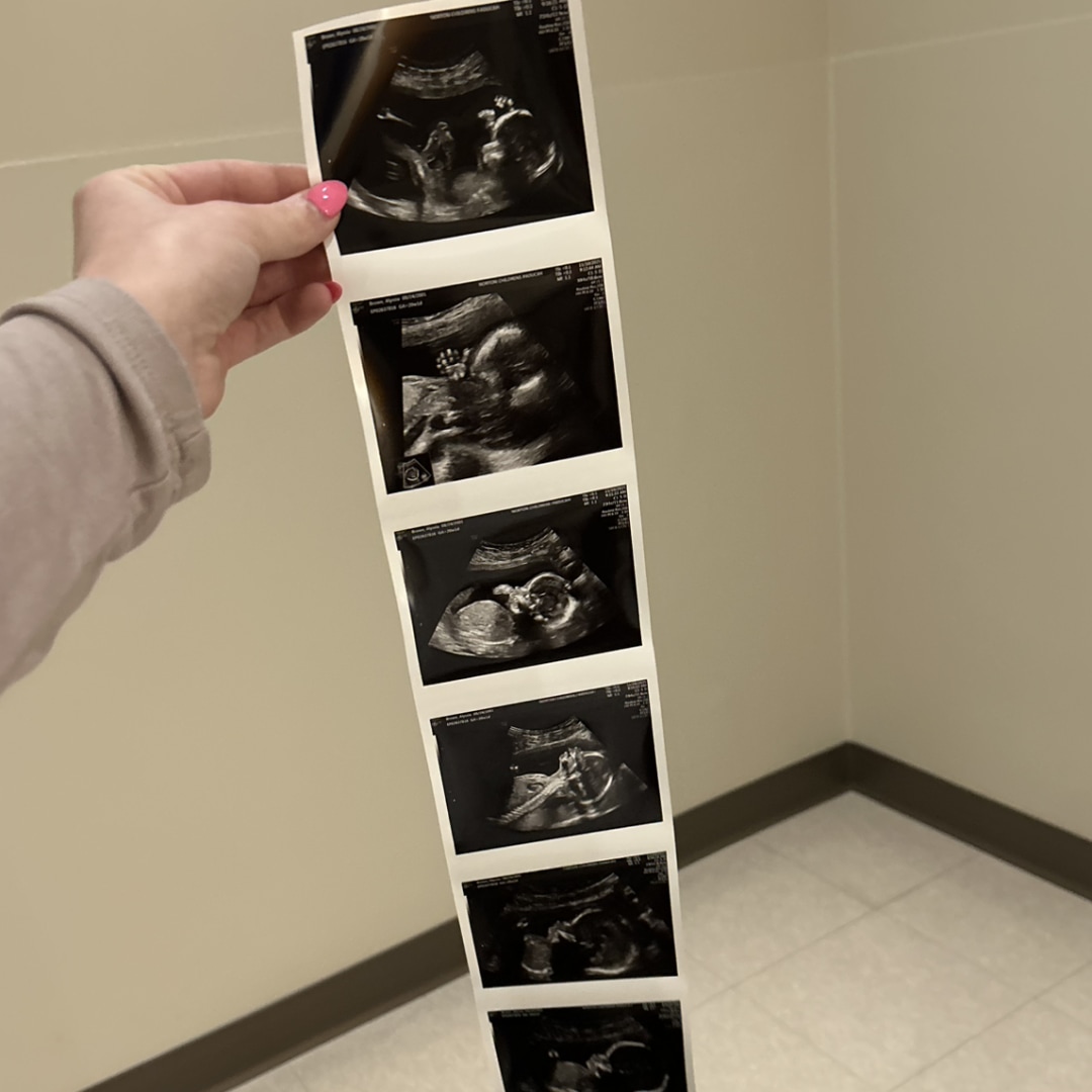 Photo shared by Alyssia for their Babylist baby registry.