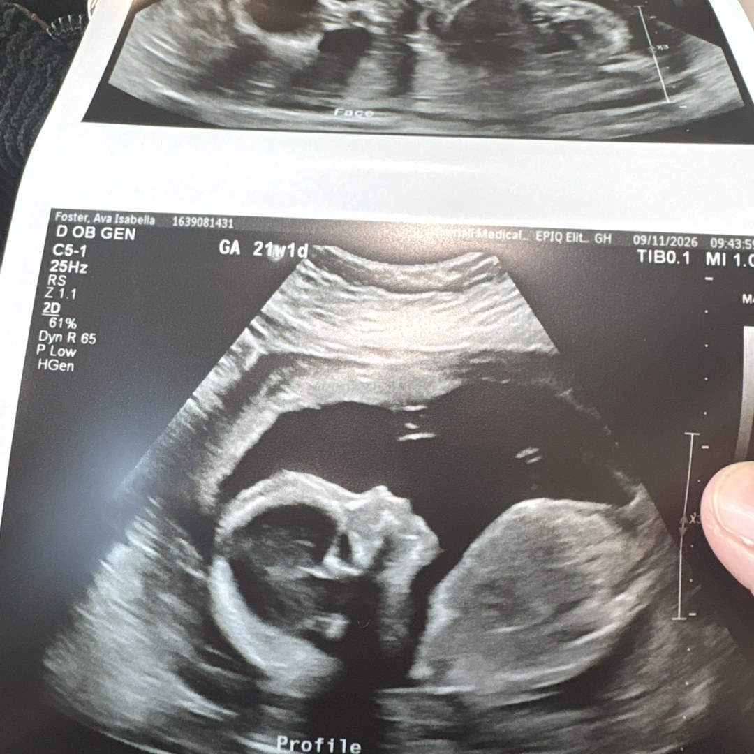 Photo shared by Ava for their Babylist baby registry.