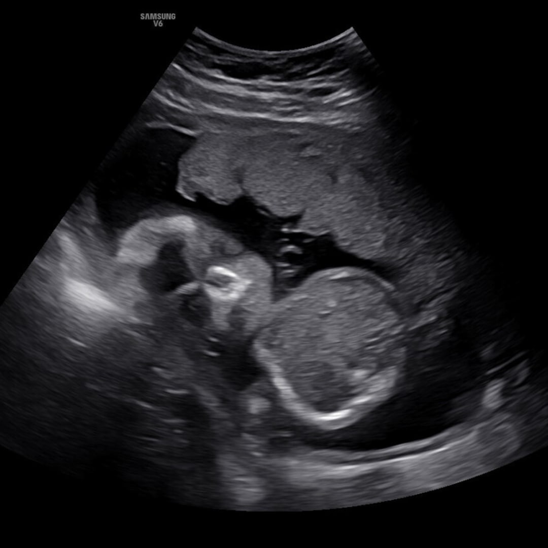 Photo shared by Landry for their Babylist baby registry.