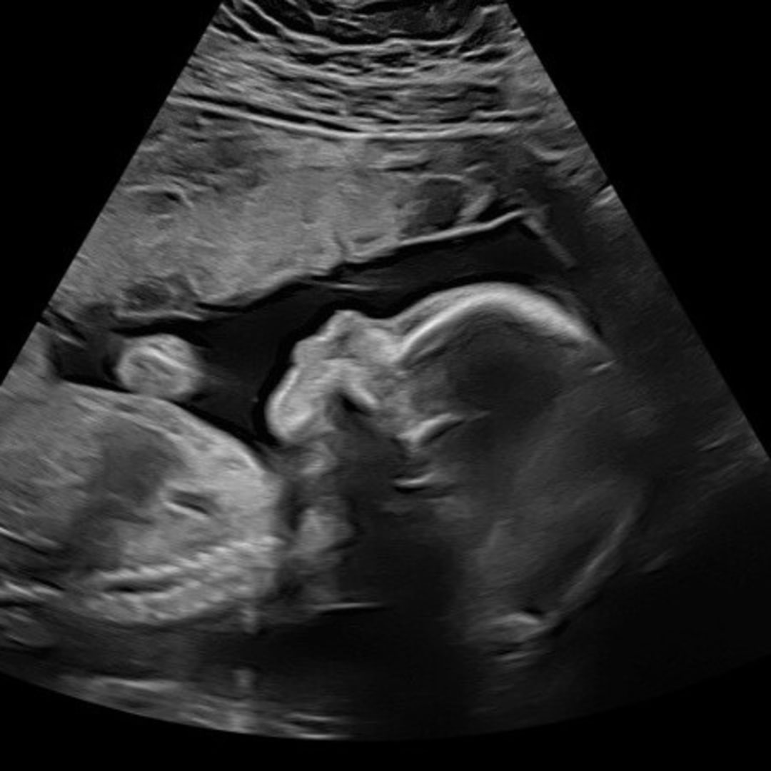 Photo shared by Ella for their Babylist baby registry.