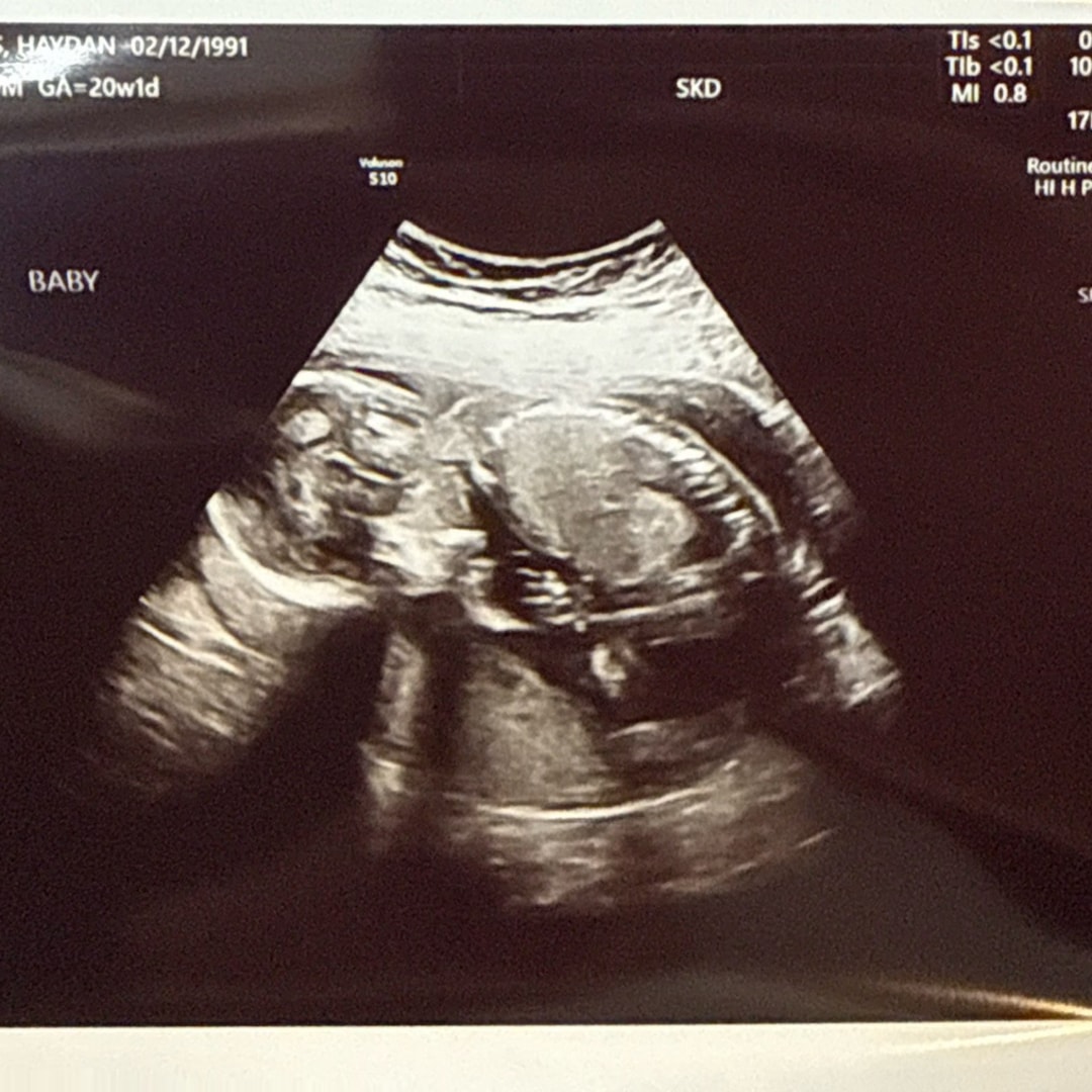 Photo shared by Haydan for their Babylist baby registry.