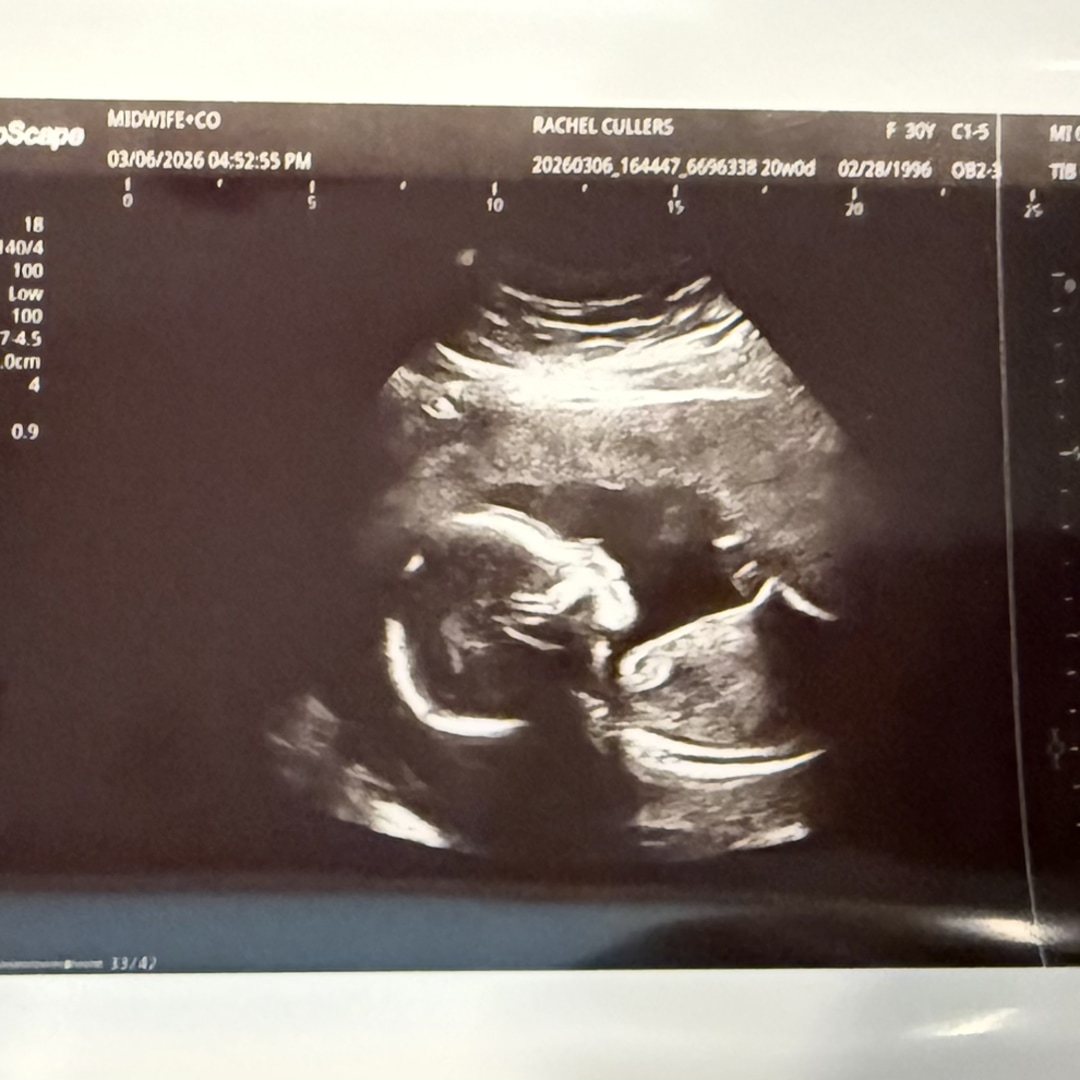 Photo shared by Rachel for their Babylist baby registry.