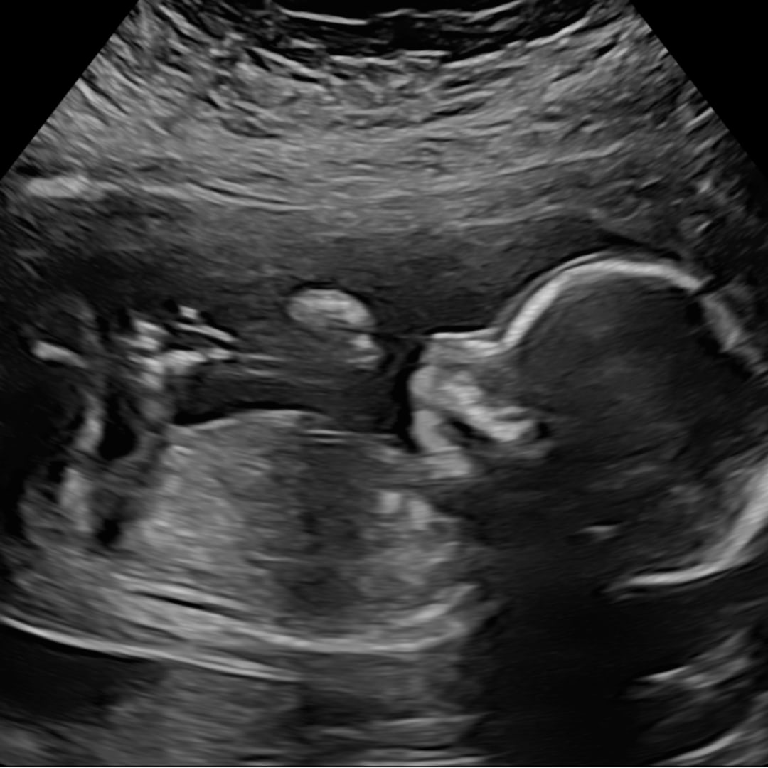 Photo shared by Marja for their Babylist baby registry.