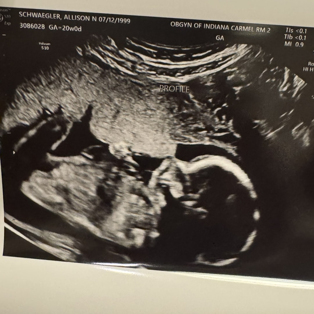 Photo shared by Alli for their Babylist baby registry.