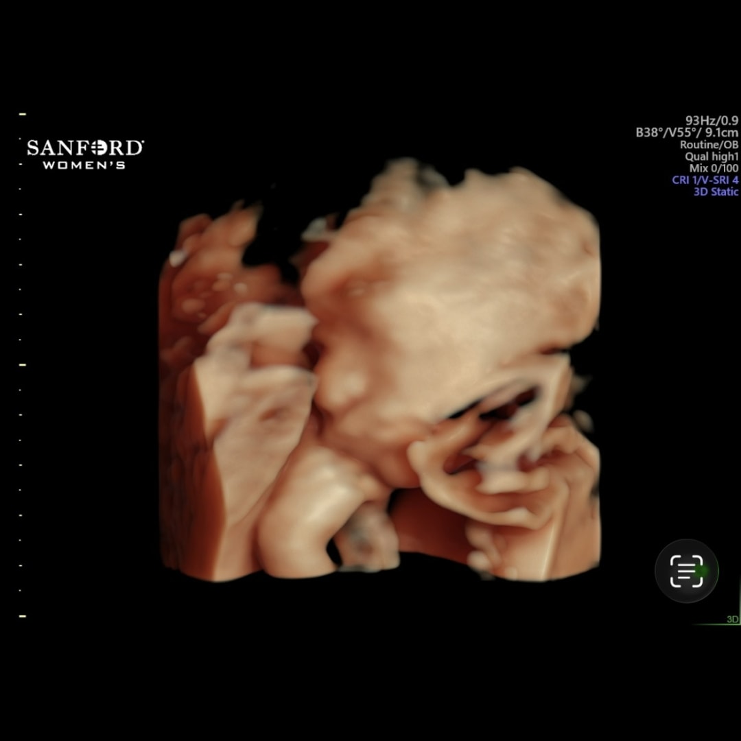 Photo shared by Karlee for their Babylist baby registry.