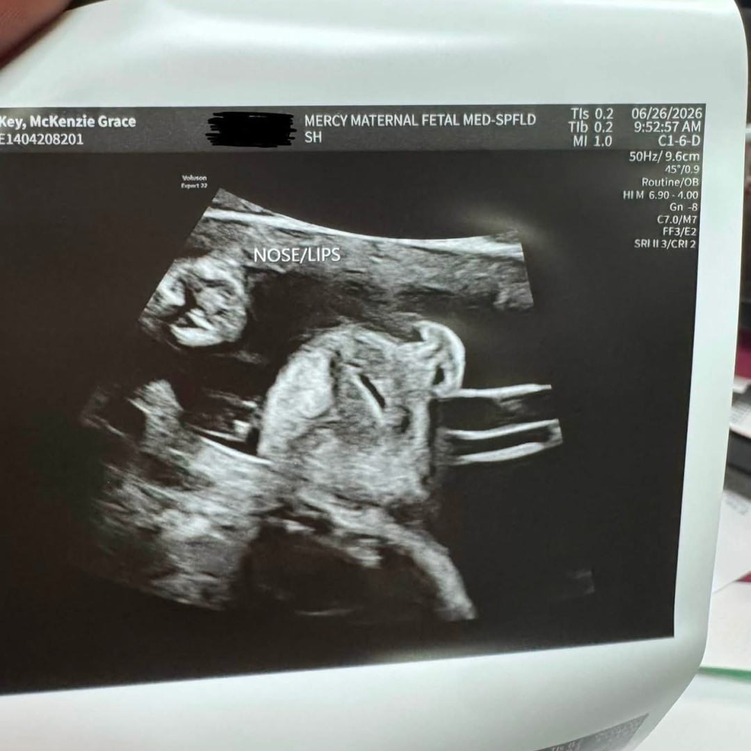 Photo shared by McKenzie for their Babylist baby registry.