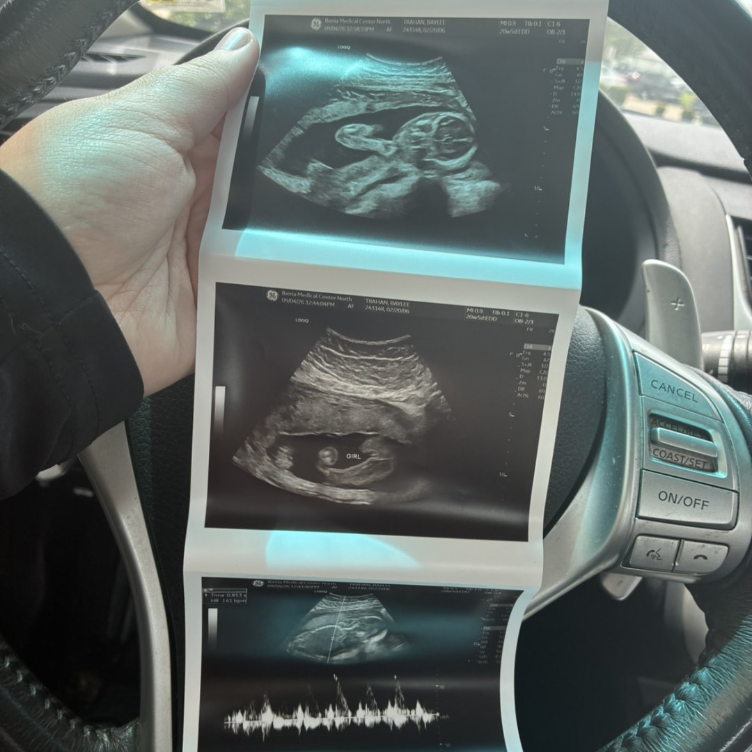 Photo shared by Baylee for their Babylist baby registry.
