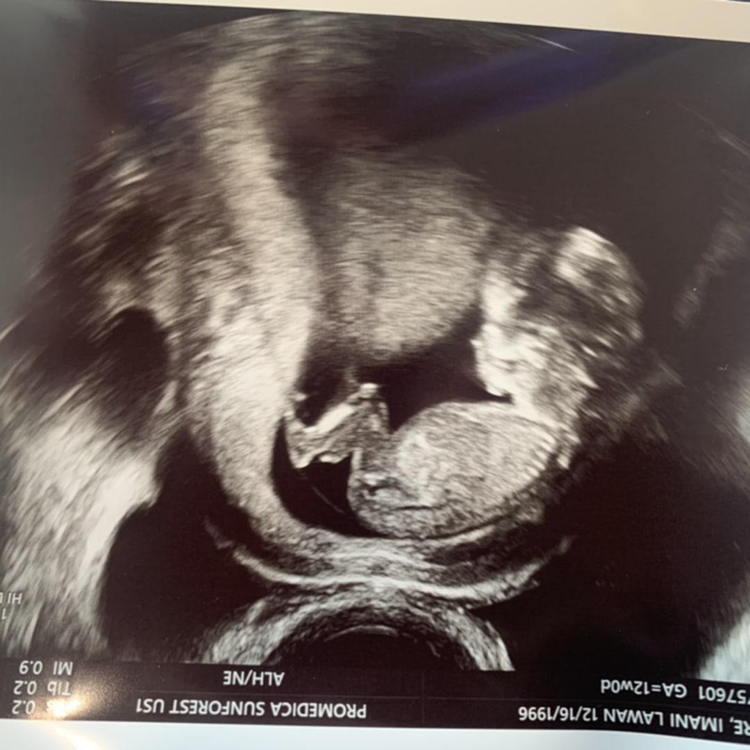 Photo shared by Imani for their Babylist baby registry.
