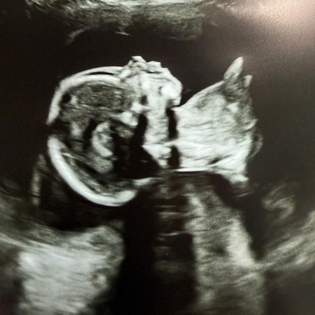 Photo shared by Hannah for their Babylist baby registry.
