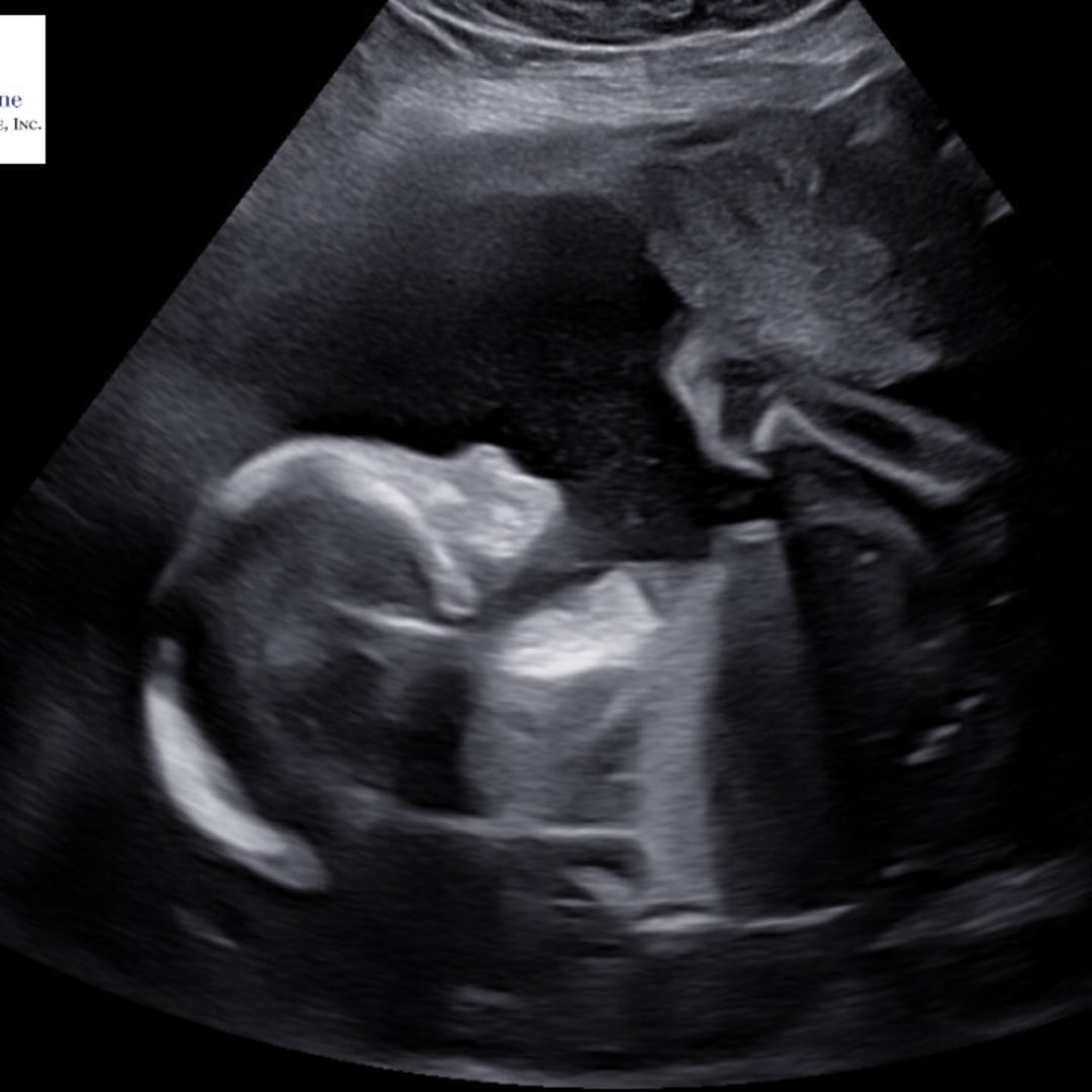 Photo shared by Dana for their Babylist baby registry.