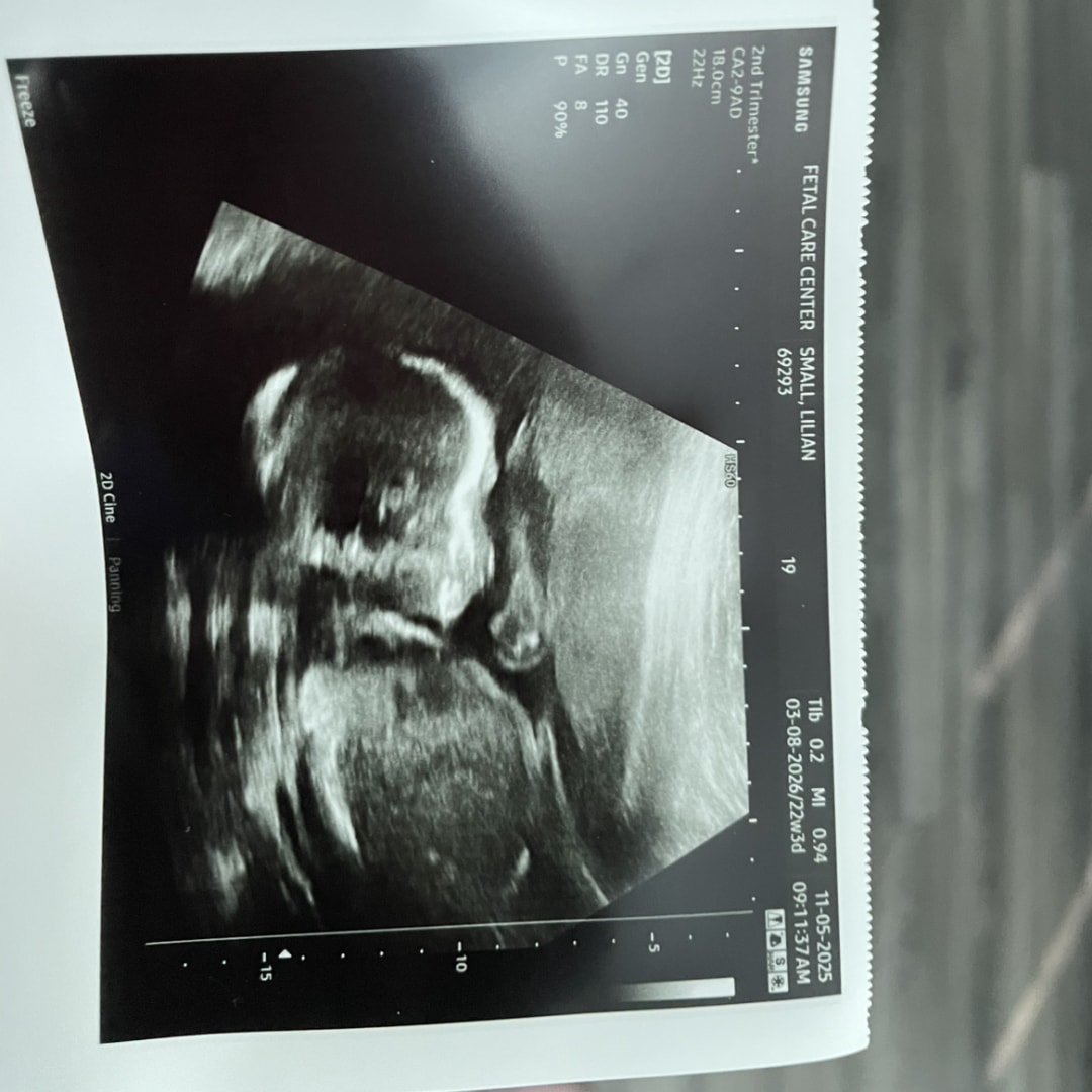 Photo shared by Lilian for their Babylist baby registry.