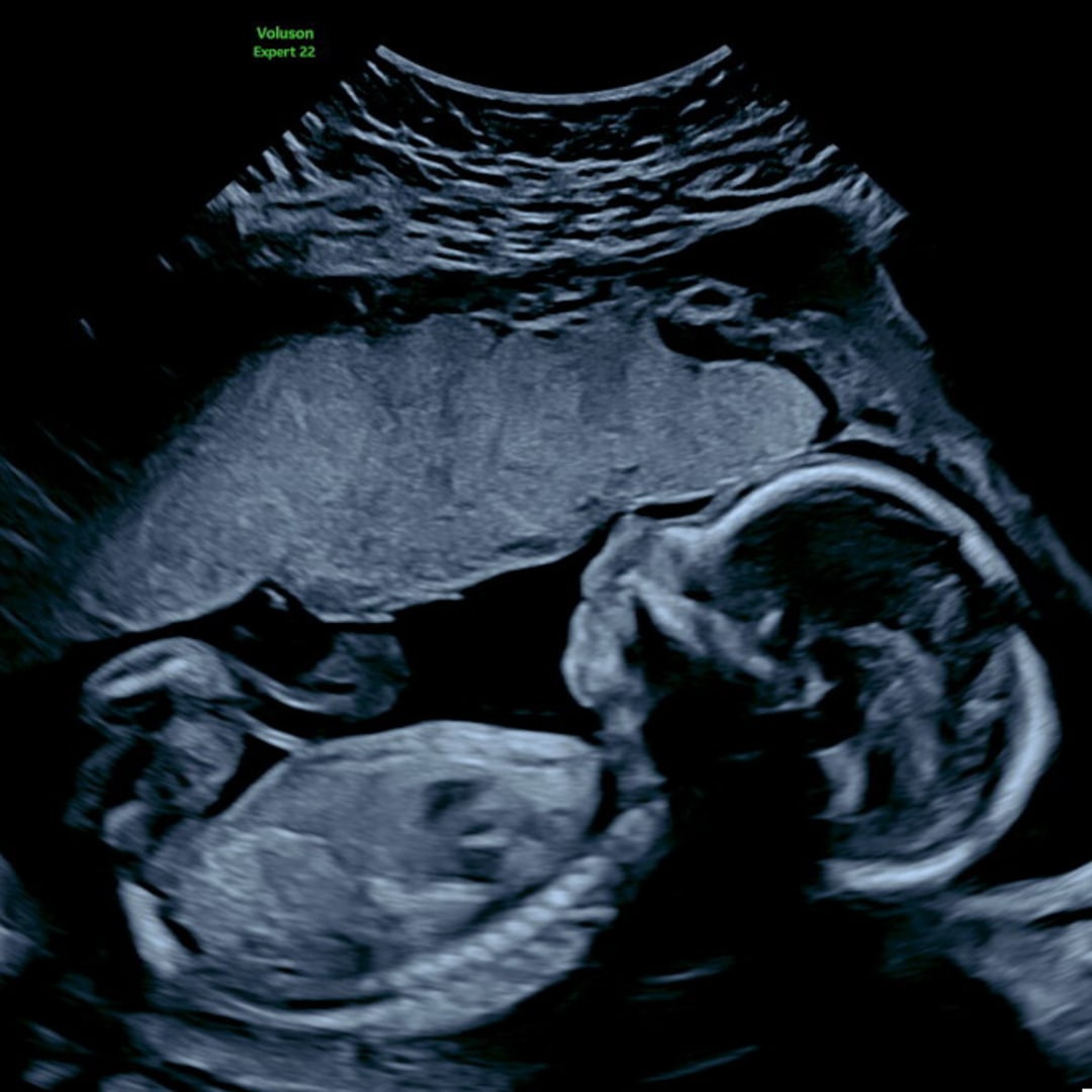 Photo shared by Adisa for their Babylist baby registry.