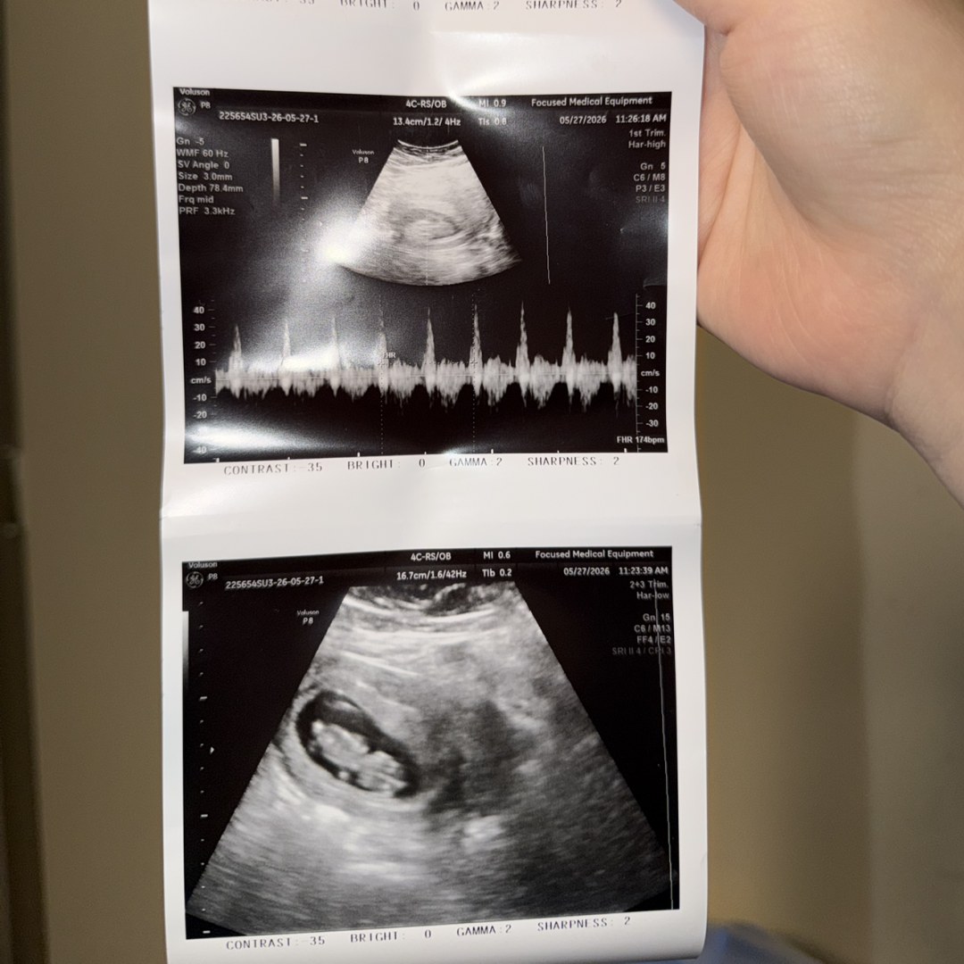 Photo shared by Trisydie for their Babylist baby registry.