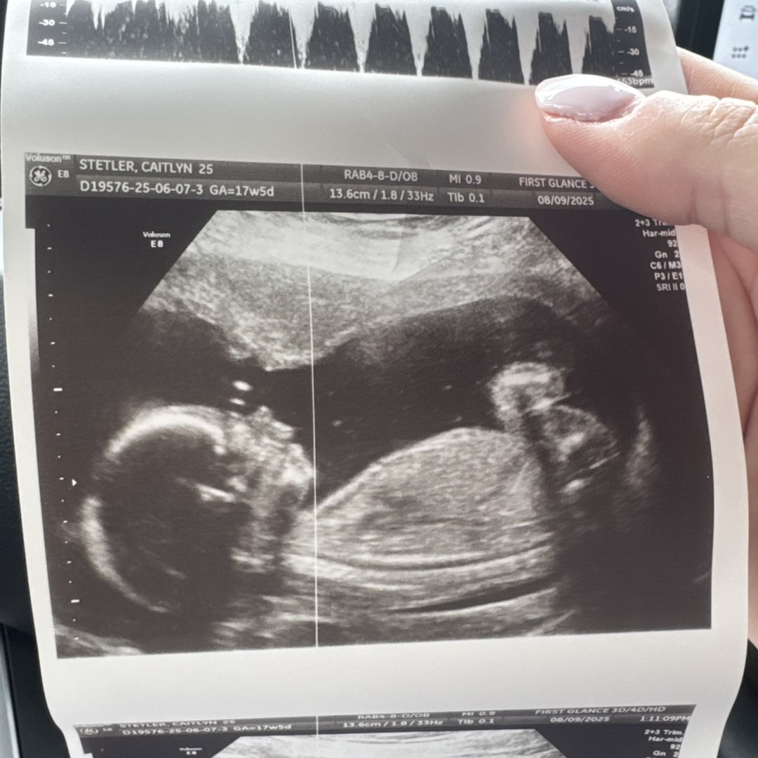 Photo shared by Caitlyn for their Babylist baby registry.