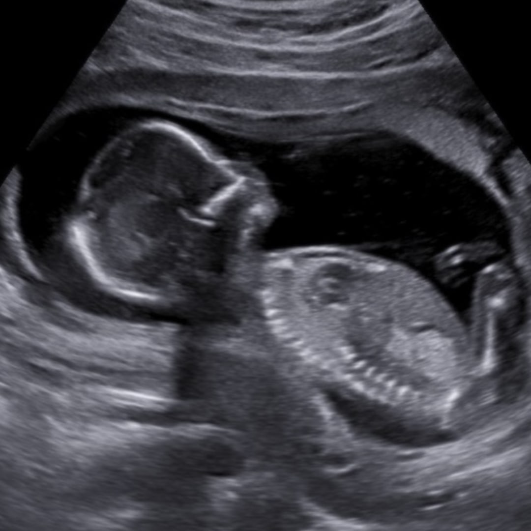 Photo shared by Elisha for their Babylist baby registry.