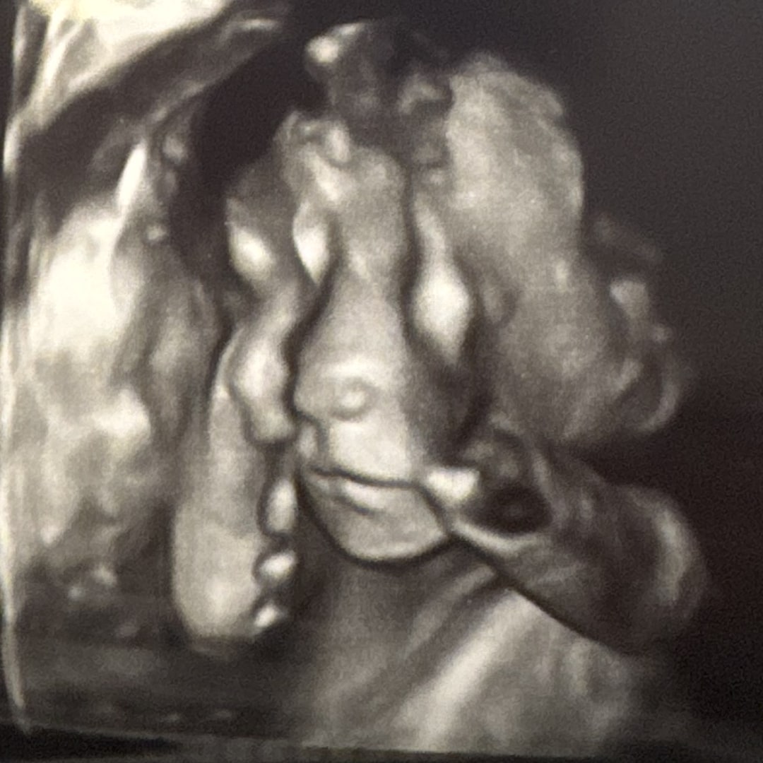 Photo shared by Katie for their Babylist baby registry.