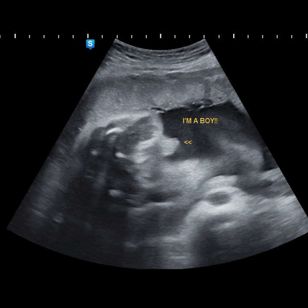Photo shared by Azesha for their Babylist baby registry.