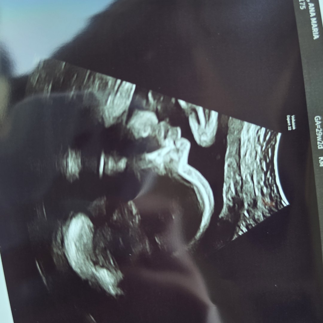 Photo shared by Ana for their Babylist baby registry.