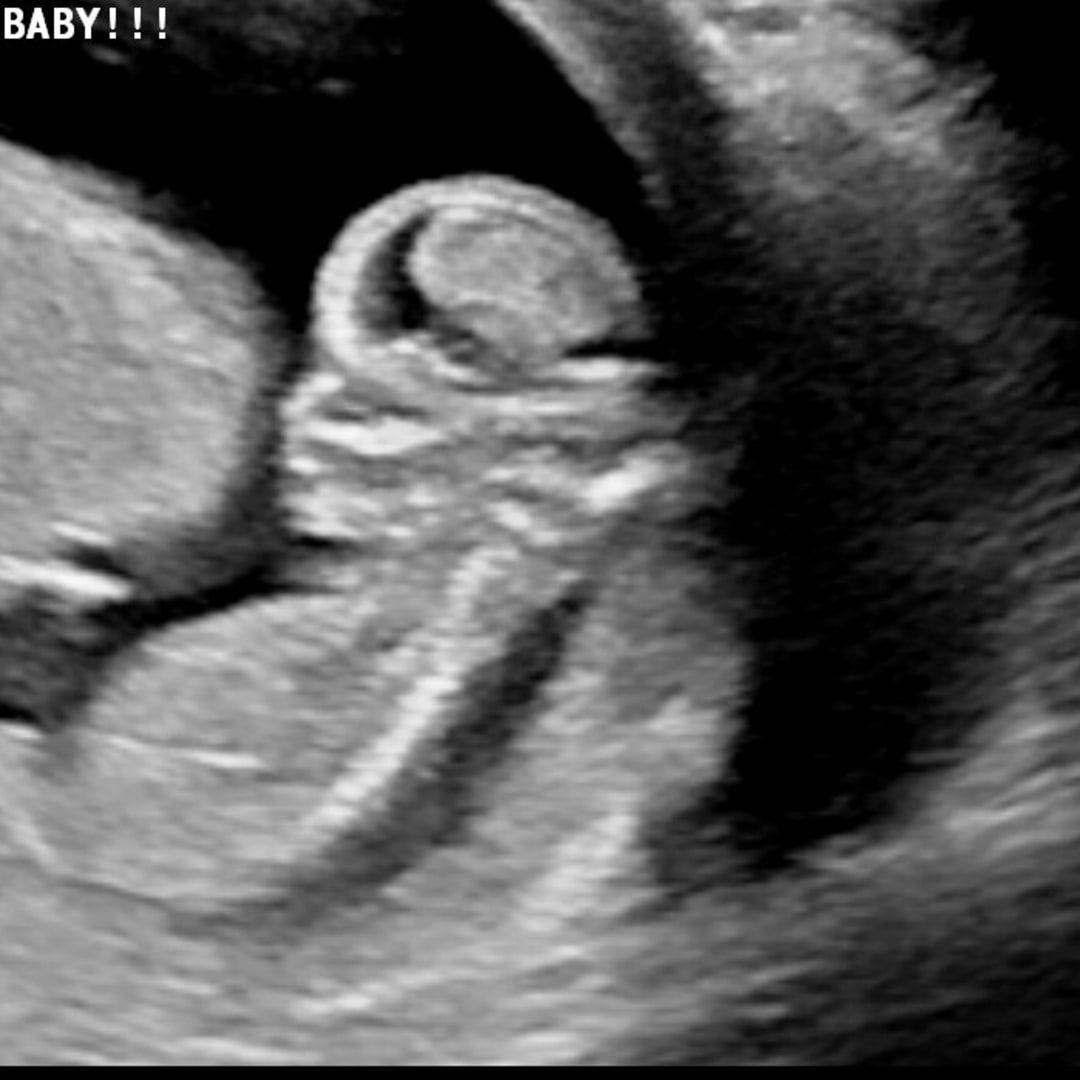 Photo shared by Eleni for their Babylist baby registry.