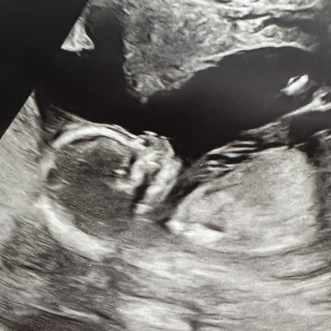 Photo shared by Amanda for their Babylist baby registry.