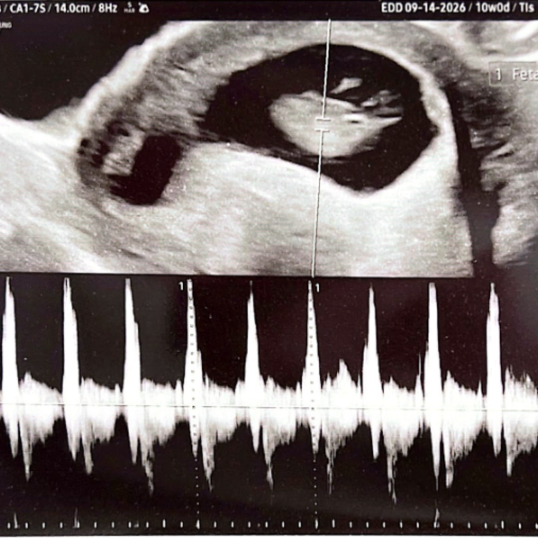 Photo shared by Abigail for their Babylist baby registry.