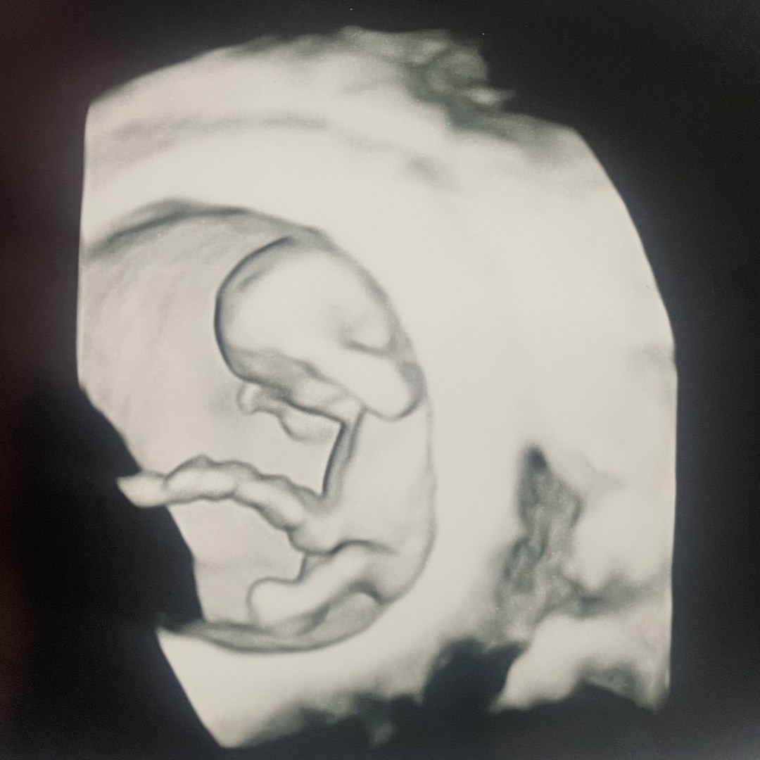 Photo shared by Tessa for their Babylist baby registry.