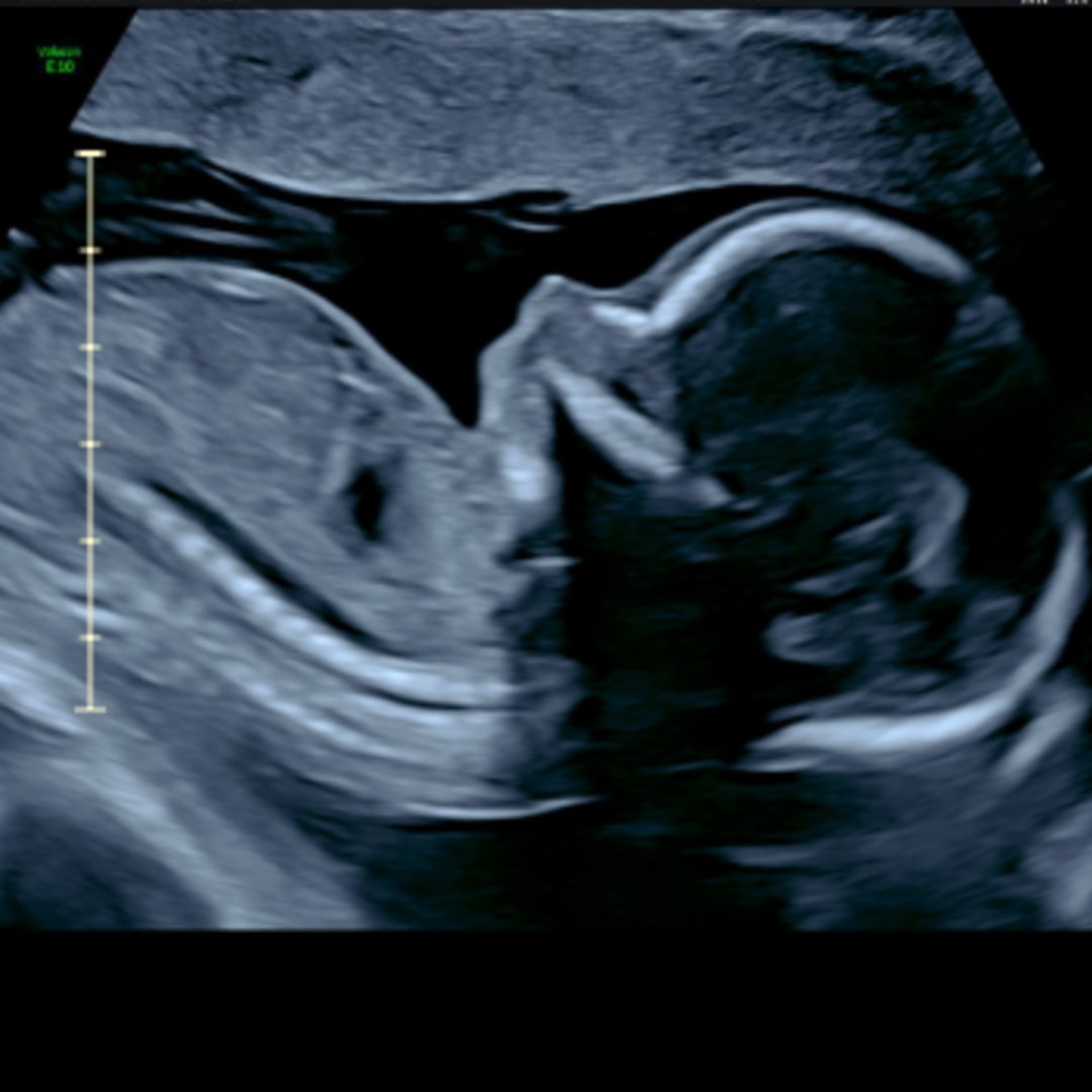 Photo shared by Isabelle for their Babylist baby registry.