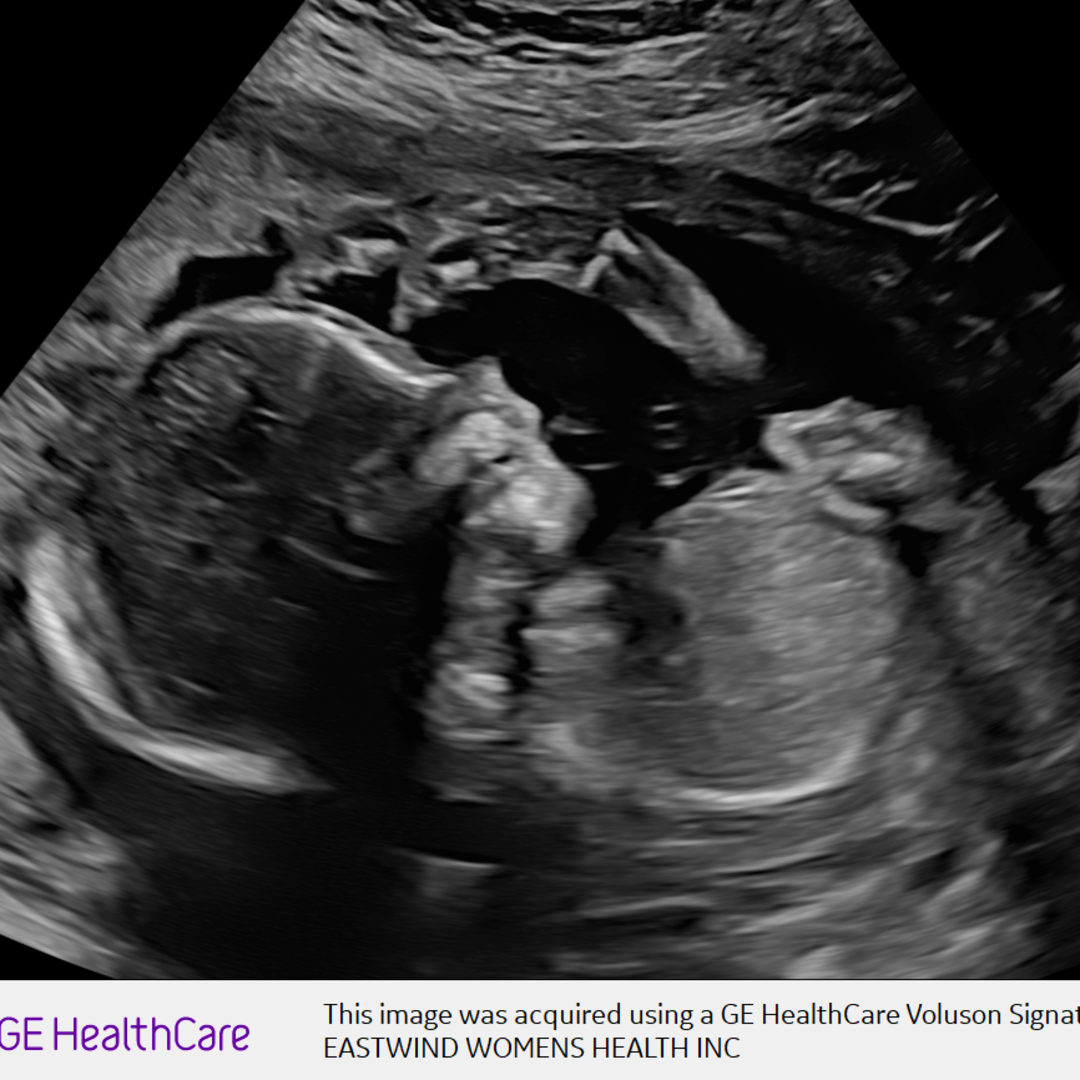 Photo shared by Savannah for their Babylist baby registry.