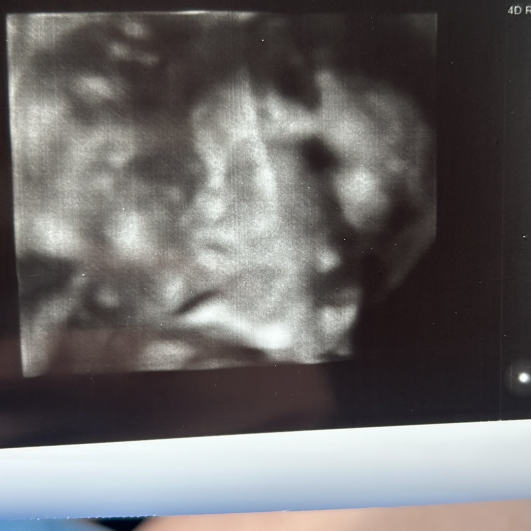 Photo shared by Julymar for their Babylist baby registry.