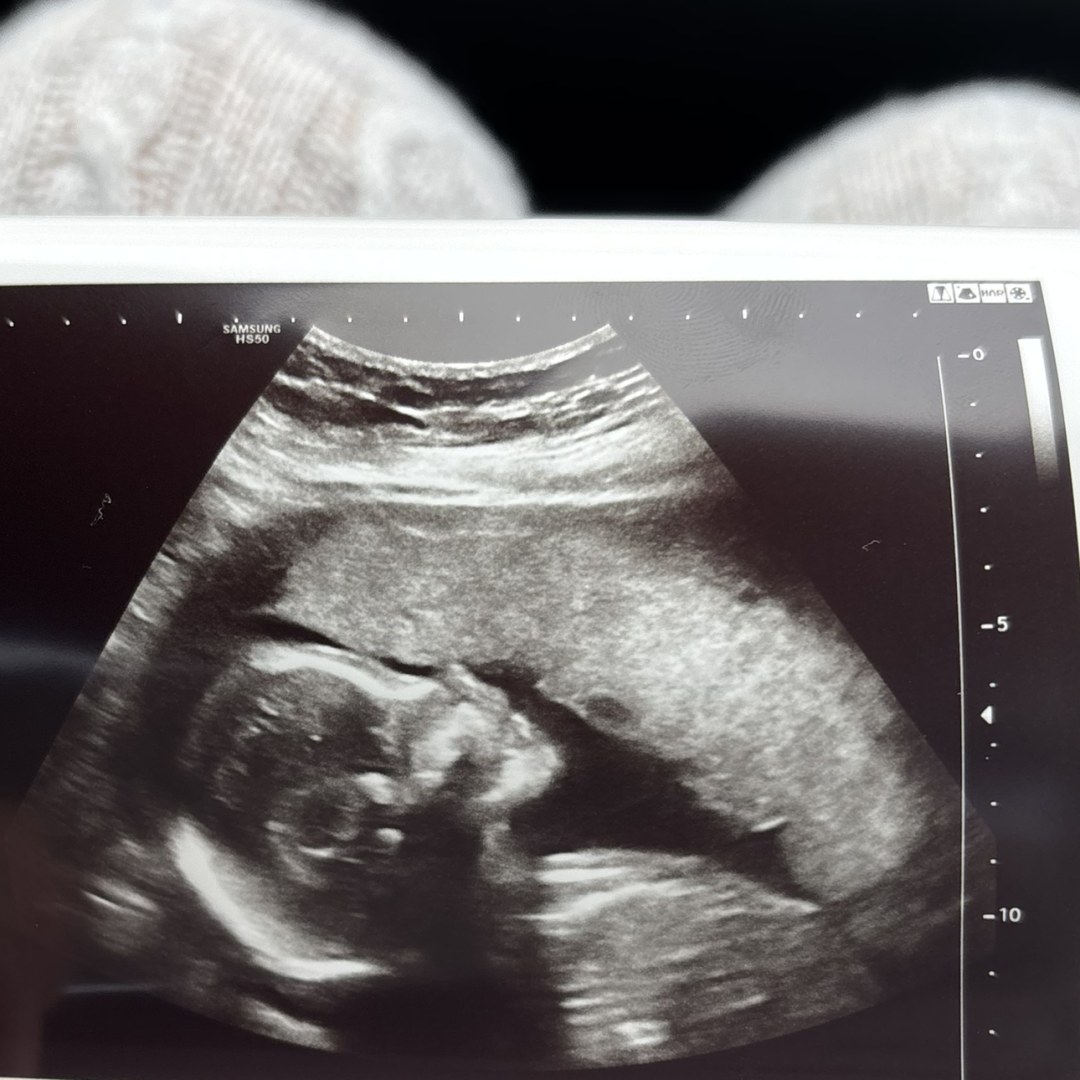 Photo shared by Stacey for their Babylist baby registry.