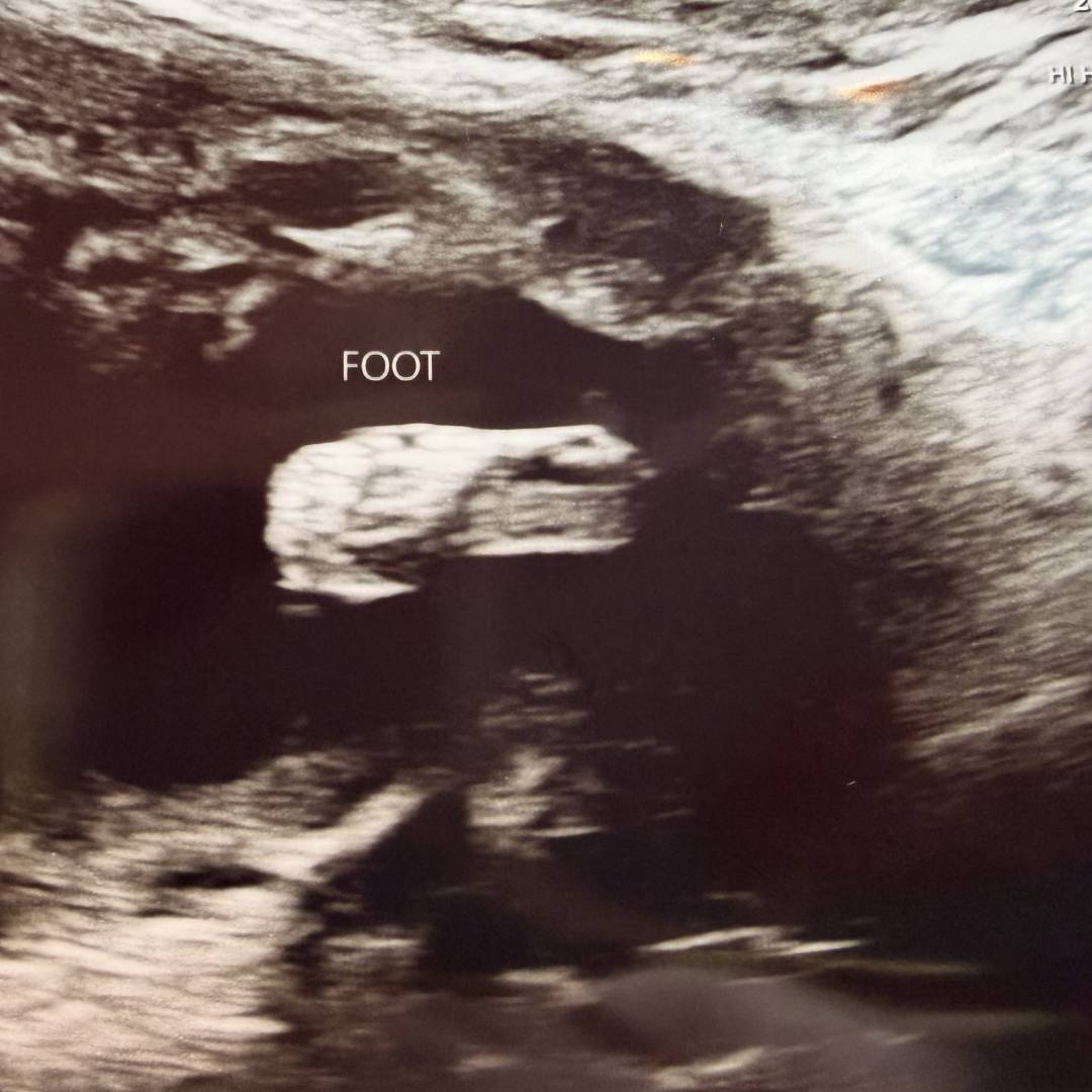 Photo shared by Emma for their Babylist baby registry.