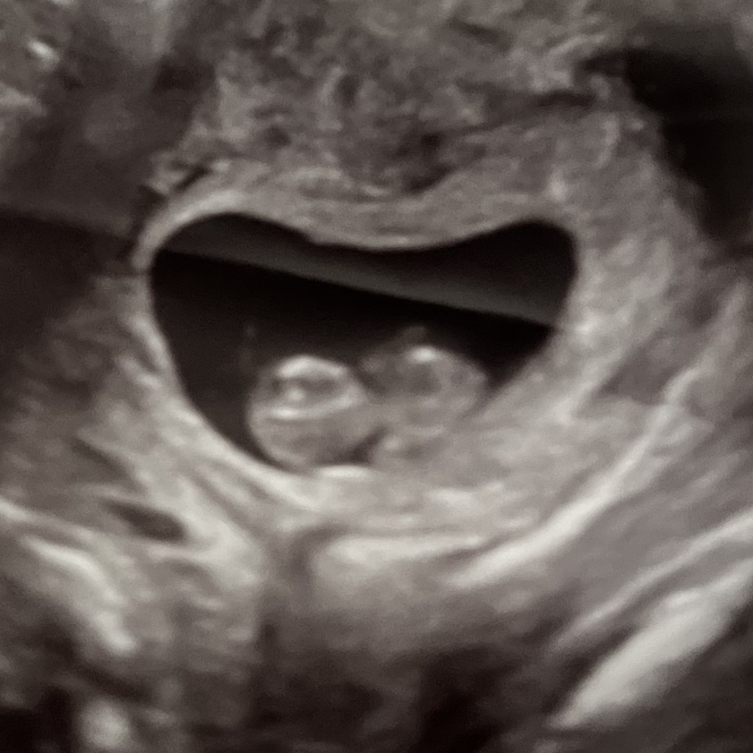 Photo shared by Mercedez for their Babylist baby registry.