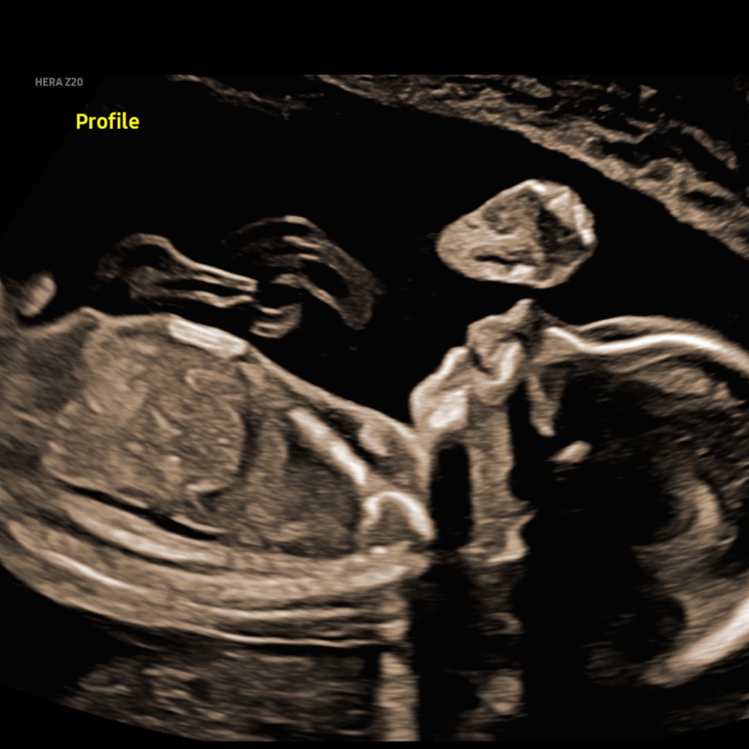 Photo shared by Brooke for their Babylist baby registry.