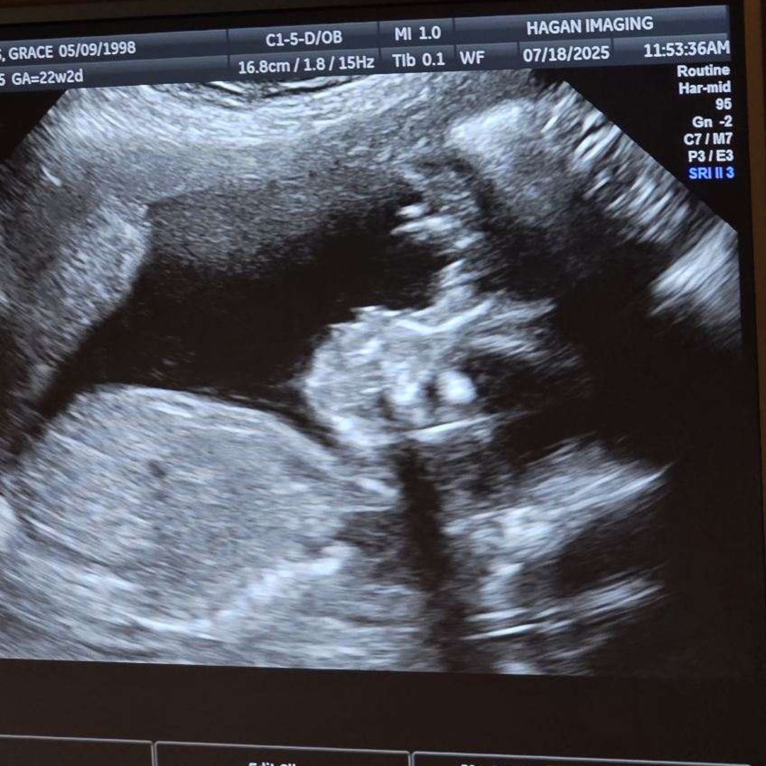 Photo shared by Grace for their Babylist baby registry.