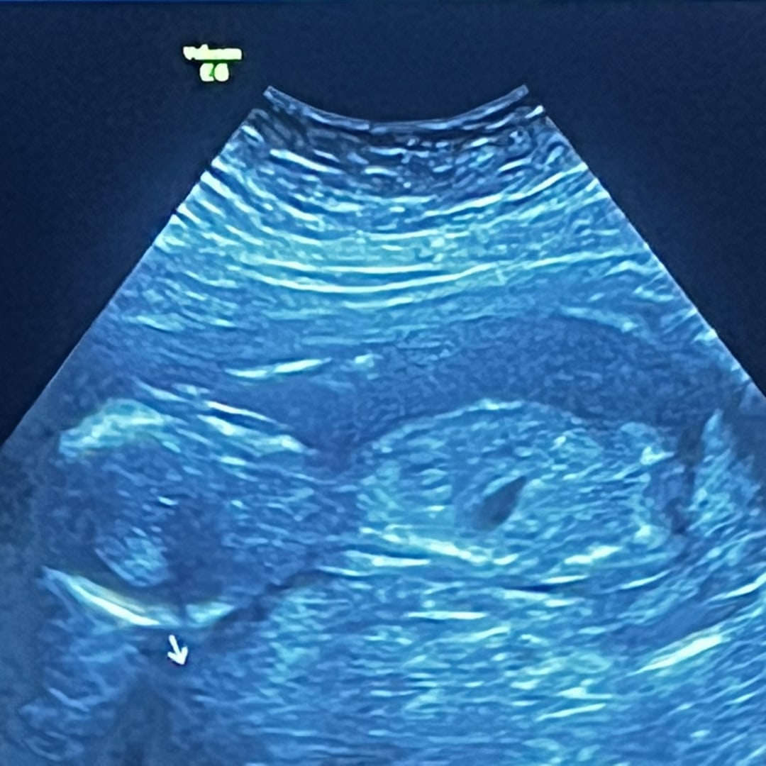 Photo shared by Ashley for their Babylist baby registry.