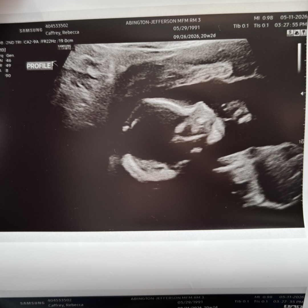 Photo shared by Rebecca for their Babylist baby registry.