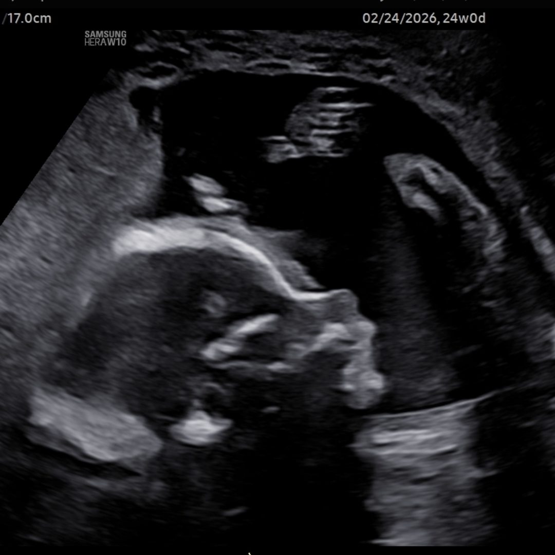 Photo shared by Stephanie for their Babylist baby registry.