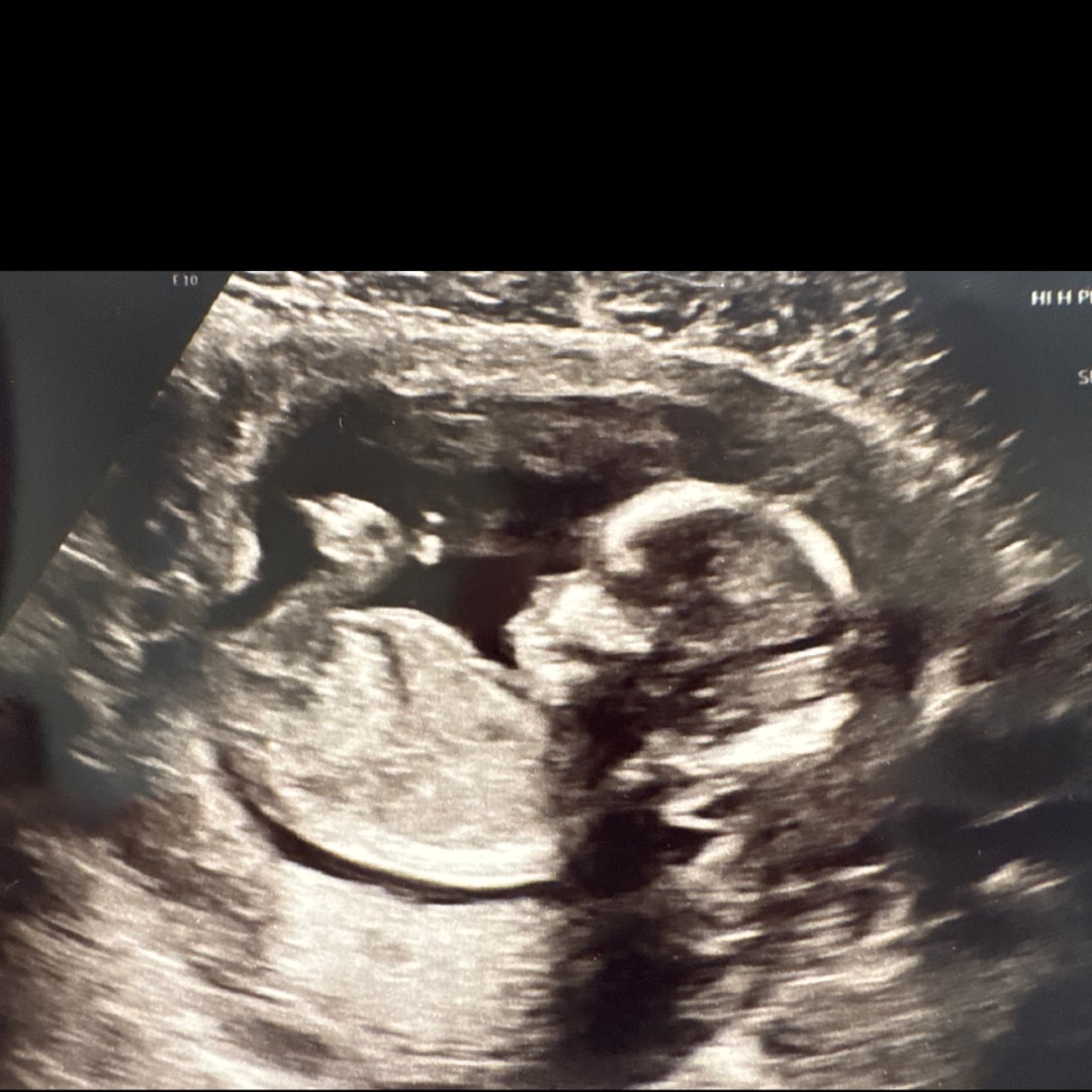 Photo shared by Kaelyn for their Babylist baby registry.