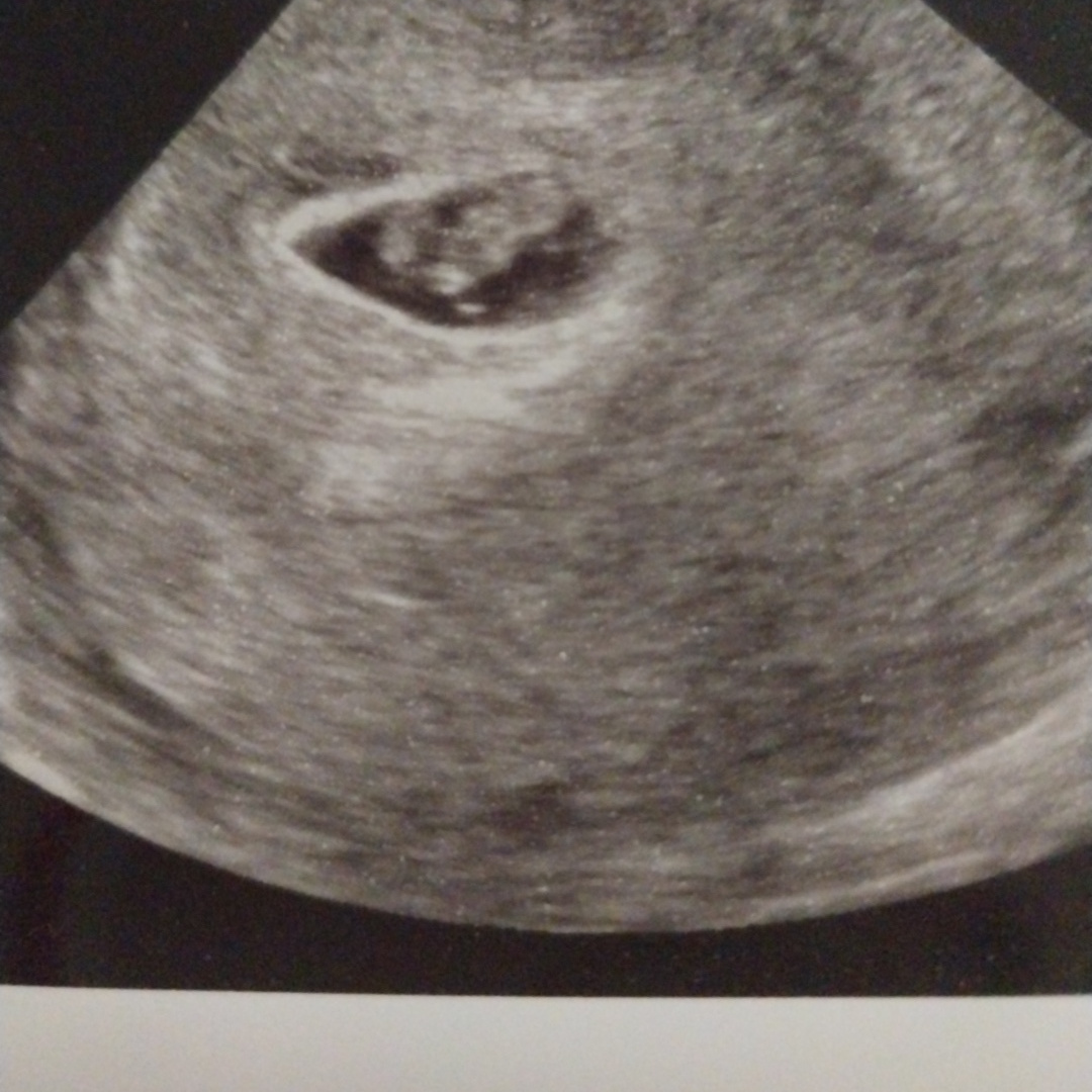 Photo shared by Wendy for their Babylist baby registry.