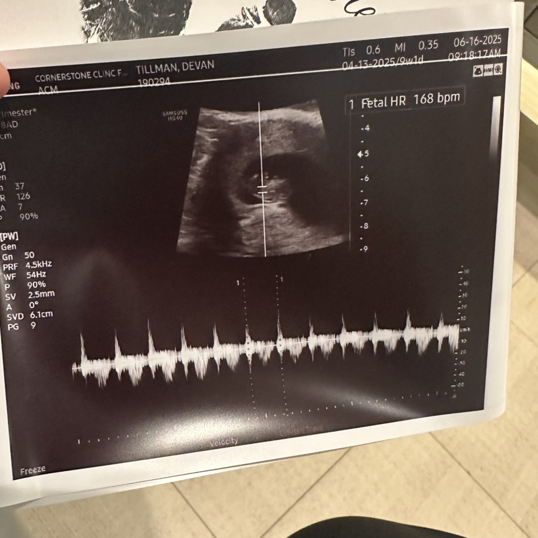 Photo shared by Devan for their Babylist baby registry.