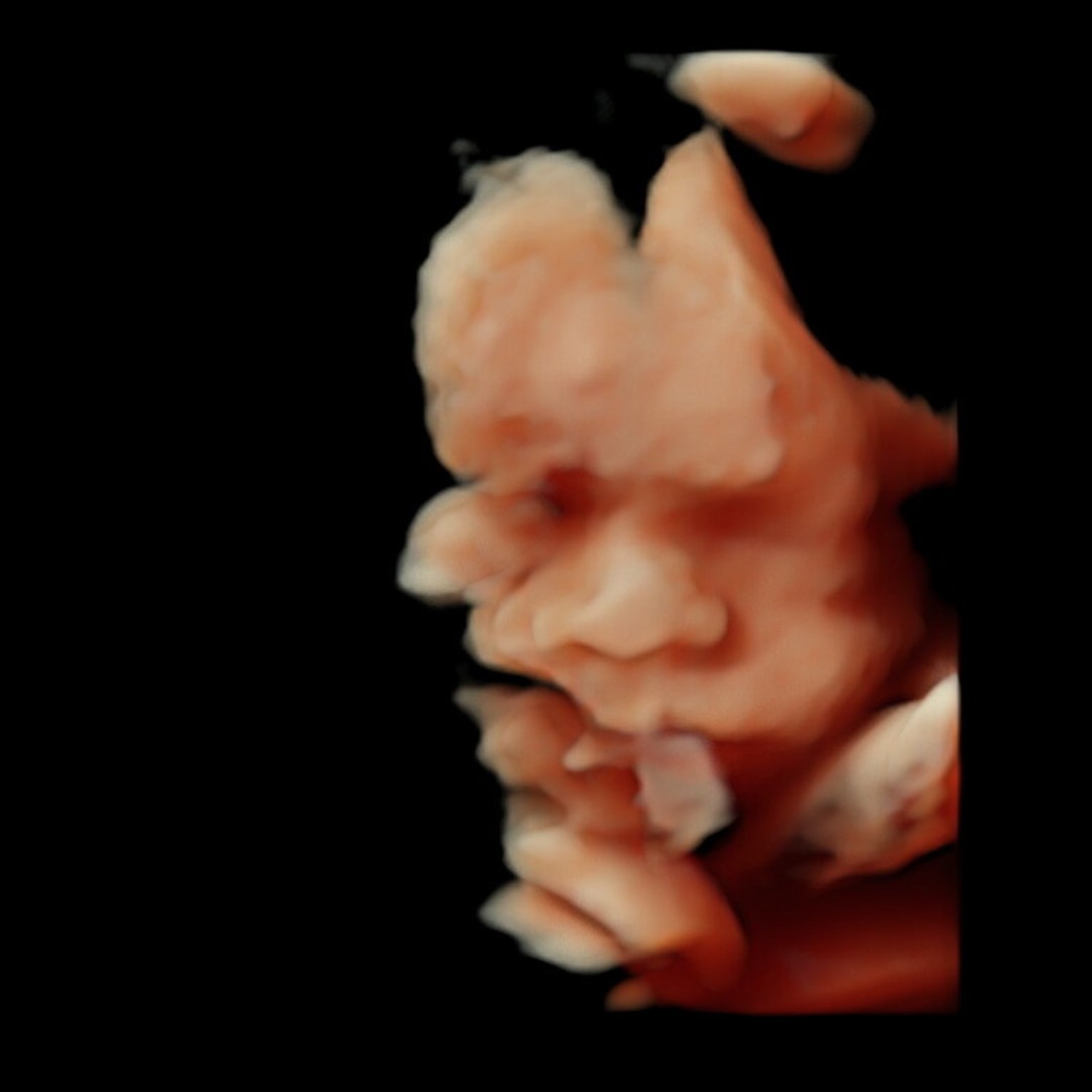 Photo shared by J’zalle for their Babylist baby registry.